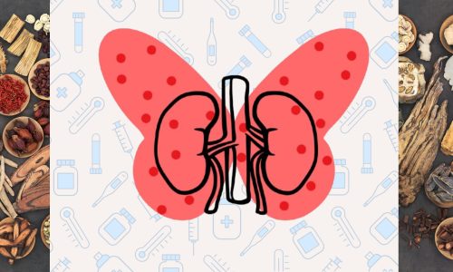 TCM management of Lupus Nephritis and HDI considerations