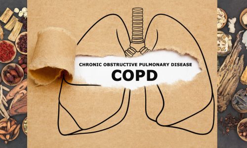 Usage of TCM and Western Medicine in treating COPD